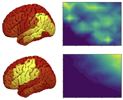 When AI language models break down, they break down like the human brain. Using BLUM's patented framework, a large language model was systematically disrupted and its errors mapped into human brain space. Left: predicted brain lesion locations (yellow = strongest alignment with actual human brain damage). Right: corresponding disruption patterns within the AI model. Top: meaning errors (e.g., "horse" → "dog"). Bottom: sound errors (e.g., "cat" → "gat"). Each error type produces a distinct spatial signature in both systems, mirroring the same dissociation observed in stroke patients. Adapted from Fridriksson et al. (2026).