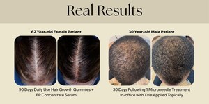 Xtressé™ Launches the First Stress-Adaptive Hair Therapy System Combining At-Home Daily Ritual with an Exclusive Medical Practice Treatment