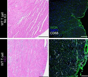 Discovery Could Make Immune Checkpoint Inhibitors Safer