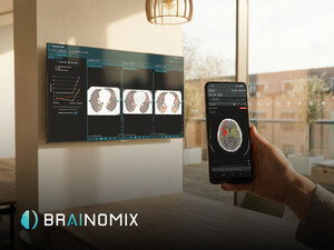 Brainomix Extends Series C Financing to $25.4M (£18.8M) to Support U.S. Expansion