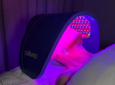 Meno "Pause" Facial at InnoVitale Spa St. St Petersburg, FL 33705