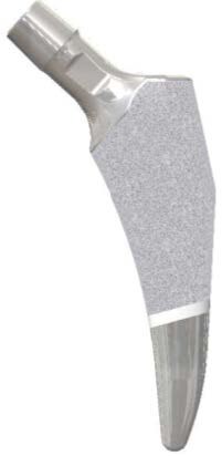 Libertas® Keystone™ Hip System