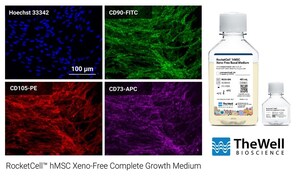 TheWell Bioscience Launches RocketCell™ hMSC Xeno-Free Complete Growth Medium for Robust and Reproducible Expansion of Human Mesenchymal Stem Cells