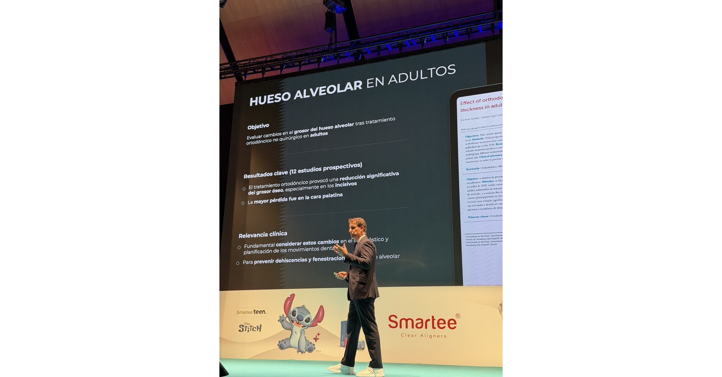 Smartee Deepens European Footprint and Showcases Integrated Mandibular Advancement Repositioning Technology at ALIGNEA 2026