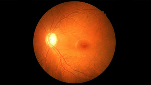 Verana Health Enhances World Renowned RWD Ophthalmic Registry with Images