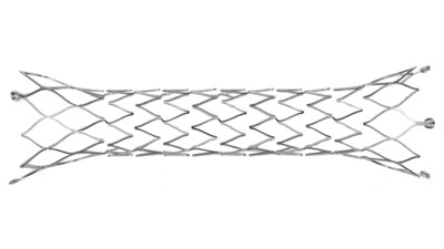 Lifeline Ductus Arteriosus Stent by Starlight Cardiovascular.