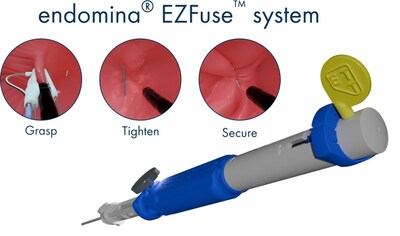 endomina EZFuse system