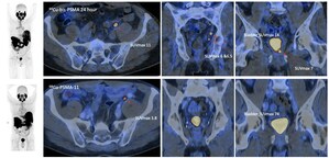 Co-PSMA data presented at EAU Annual Congress 2026 with manuscript accepted for publication in the European Urology journal