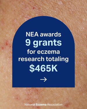 THE NATIONAL ECZEMA ASSOCIATION (NEA) AWARDS 9 GRANTS FOR ECZEMA RESEARCH