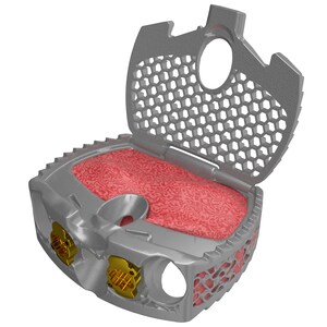 Spinal Elements Expands Ventana® Platform with FDA 510(k) Clearance and First Cases of Ventana® A ALIF System