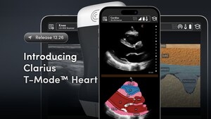 Clarius Unveils T-Mode™ Heart: New AI-Powered Training Tool Empowers Primary Care Physicians to Perform Cardiac Ultrasound Exams