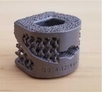 SpinePoint Flex-Z™ Cervical Cage