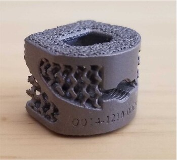 SpinePoint Flex-Z™ Cervical Cage