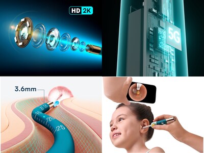 Bebird EarSight Ultra