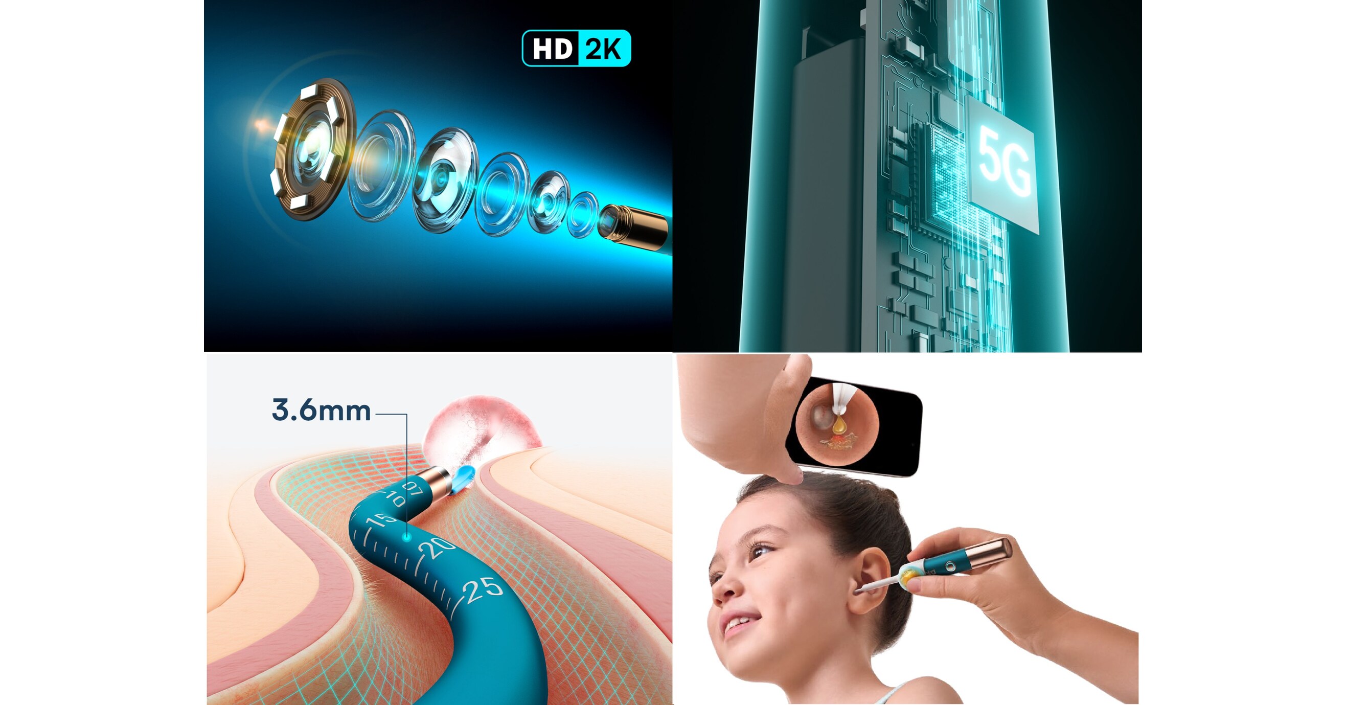 Bebird Launches EarSight Ultra : The 5G-Powered Ear Care Solution for Modern Families Pursuing a Quality Life