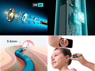 Bebird EarSight Ultra