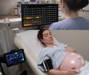Sibel Health Receives FDA-Clearance for ANNE® Maternal, a Comprehensive and Fully Wireless Maternal-Fetal Monitoring Platform