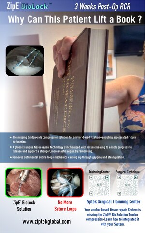 Ziptek Introduces Breakthrough ZipE® Biolock™ Technology, Redefining Tissue Repair Worldwide