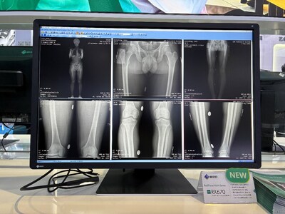 Unable to view the image, Please provide a valid URL.