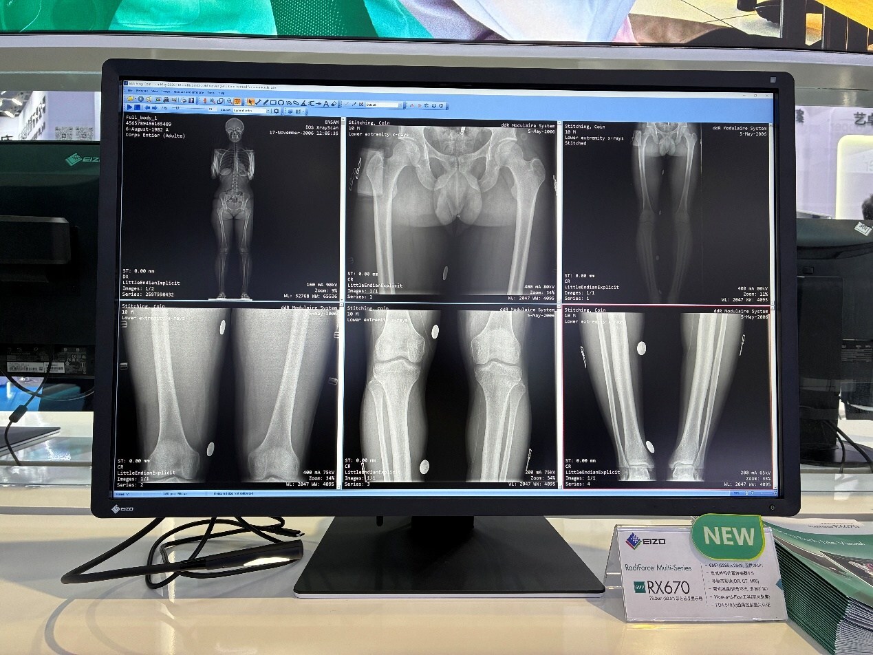 Unable to view the image, Please provide a valid URL.