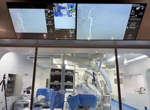 PANVIS STAR Vascular Interventional Robotic System Redefines Mechanical Thrombectomy