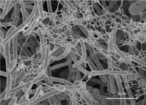 Meiji Holdings Co., Ltd. Highlights that Yogurt Containing Bacteria Metabolite Shows a Tendency Toward Higher Response When Added to Immune Checkpoint Inhibitor Therapy in People Living with Non-small Cell Lung Cancer