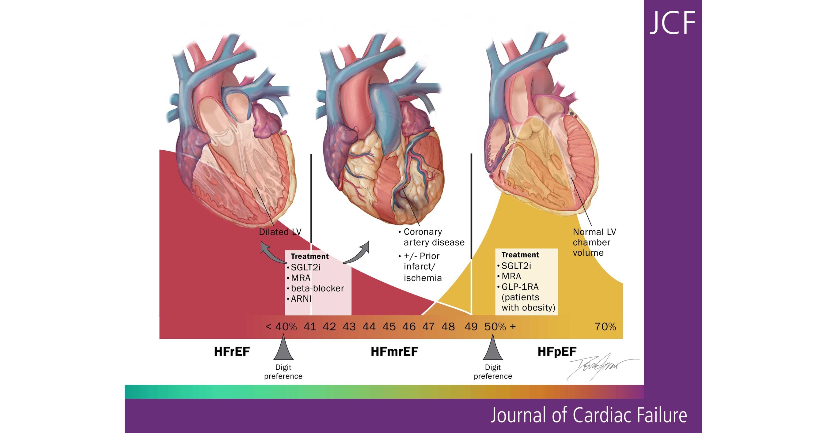 New HFSA Scientific Statement Provides Practical Guidance for Managing Heart  Failure with Mildly Reduced Ejection Fraction