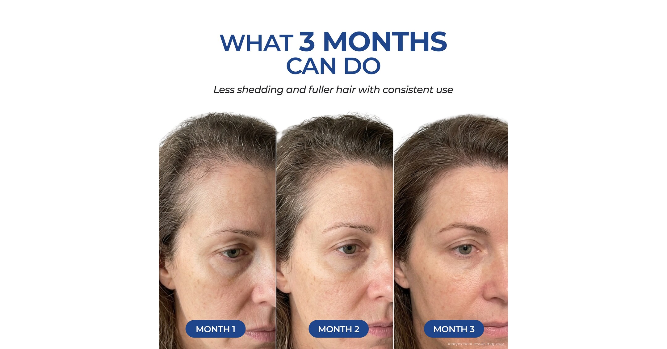 ghk-cu hair growth clinical trial GHK-Cu Copper Peptide Benefits, Uses & Safety main image 0