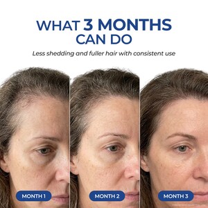 Two Ingredients. Real Hair Transformations. How Neurogan Health's GHK-Cu Serum Is Changing What Customers Expect From Hair Care