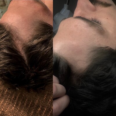 Before & After Neurogan Health GHK-Cu Hair Serum