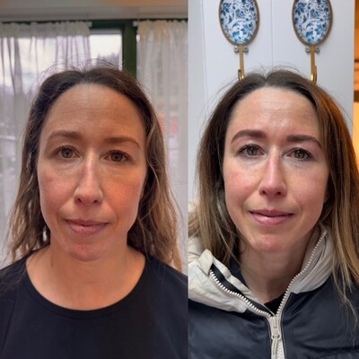 Before & After Neurogan Health's GHK-Cu Hair Serum