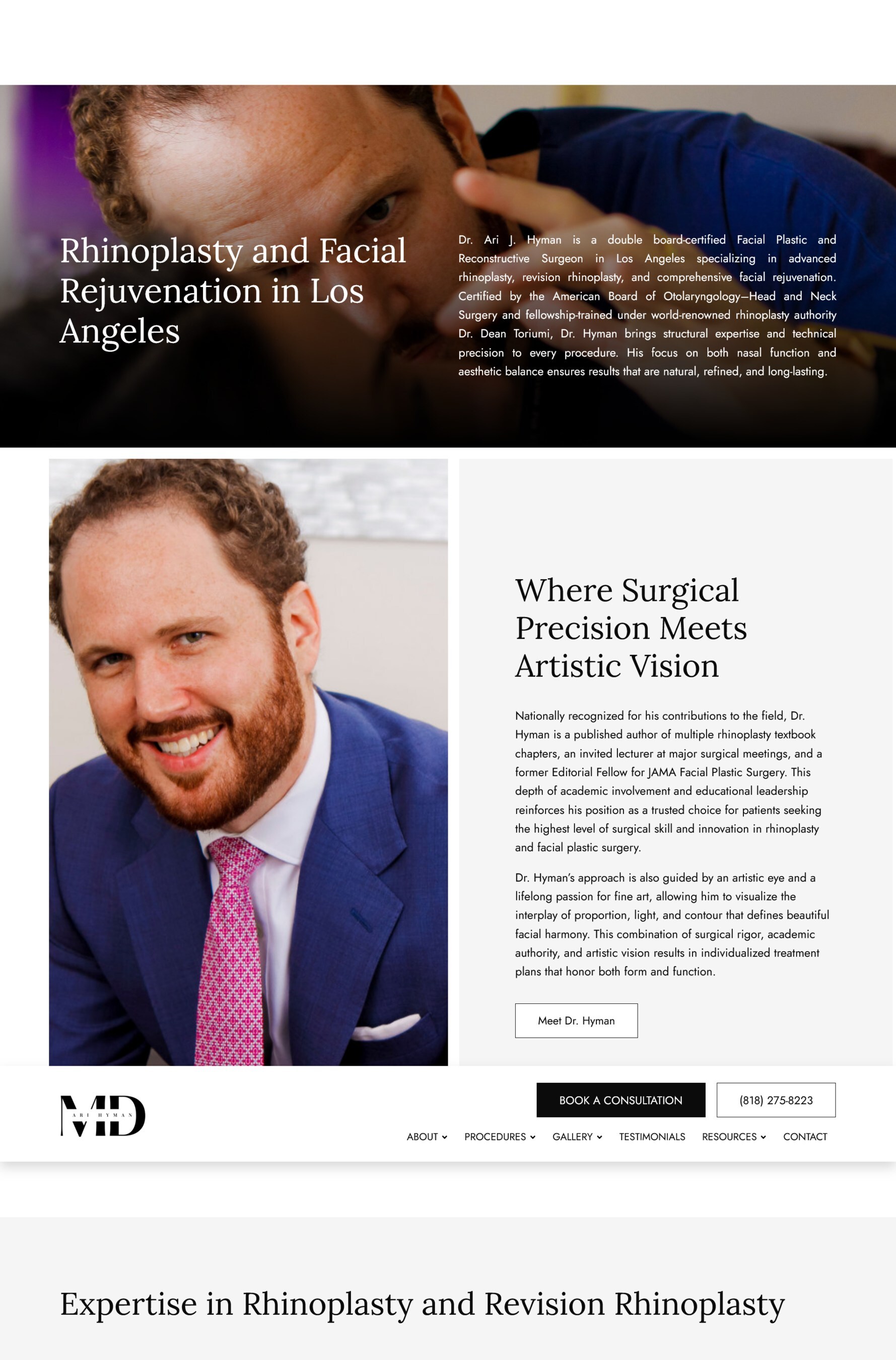 Los Angeles Rhinoplasty Specialist and Facial Plastic Surgeo