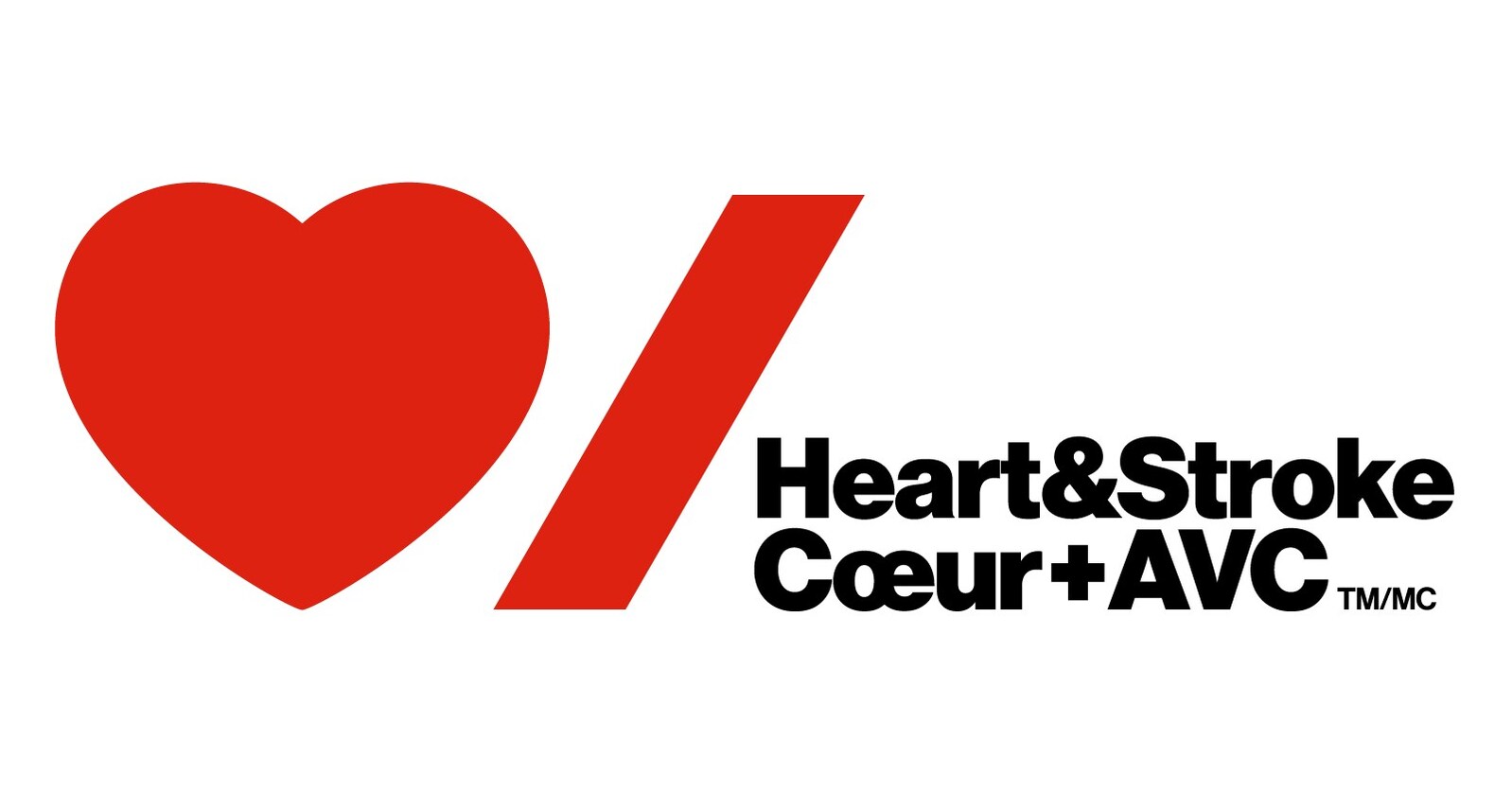 Celebrating 20 Years of Canadian Stroke Best Practice Recommendations - News Directory 3