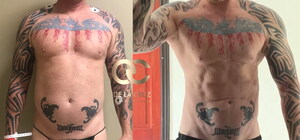 How Artificial Intelligence Is Redefining the Search for America's Top Liposuction Surgeons