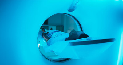 Cochlear Nucleus implants (CI1000 Nexa and CI600) are designed to support routine access to MRI at commonly used strengths (1.5T and 3.0T) without magnet removal.