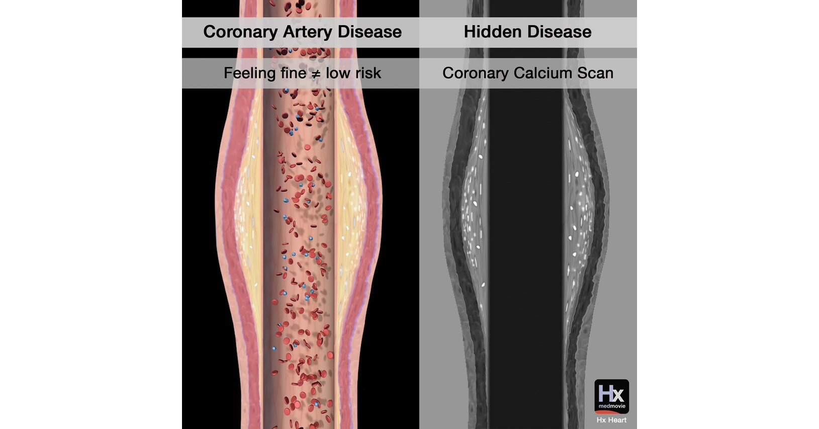 Medmovies Hx Heart Video Library Powers Patient Education at Cardiovascular Practices Worldwide Medmovies Hx Heart Video Library Powers Patient Education at Cardiovascular Practices Worldwide