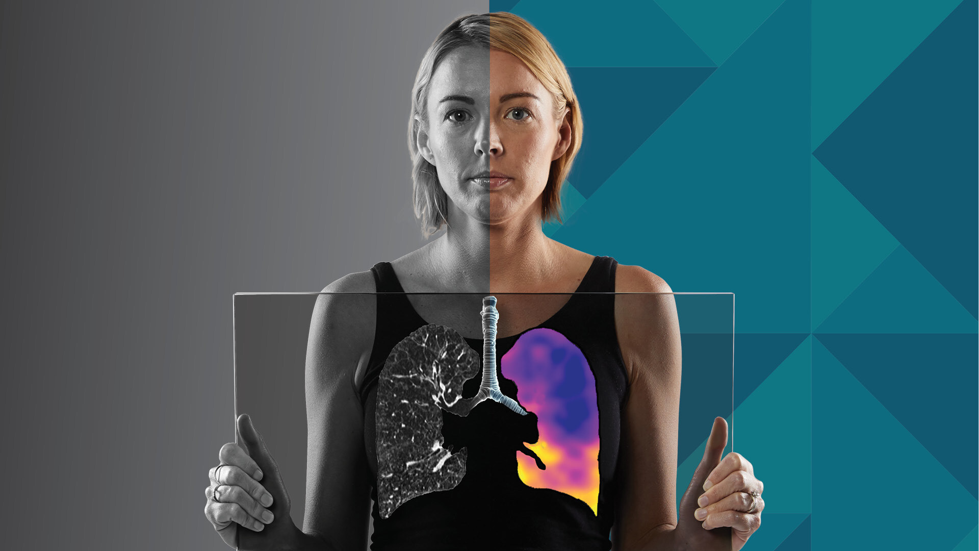 4DMedical recibe la aprobación de la TGA para CT:VQ™ y su introducción en Australia