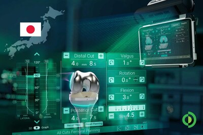 Advita Ortho’s next-generation knee replacement platform has been used clinically for the first time in Japan, bringing together advanced polyethylene, computer-assisted surgery and balancing intelligence in a unified workflow.