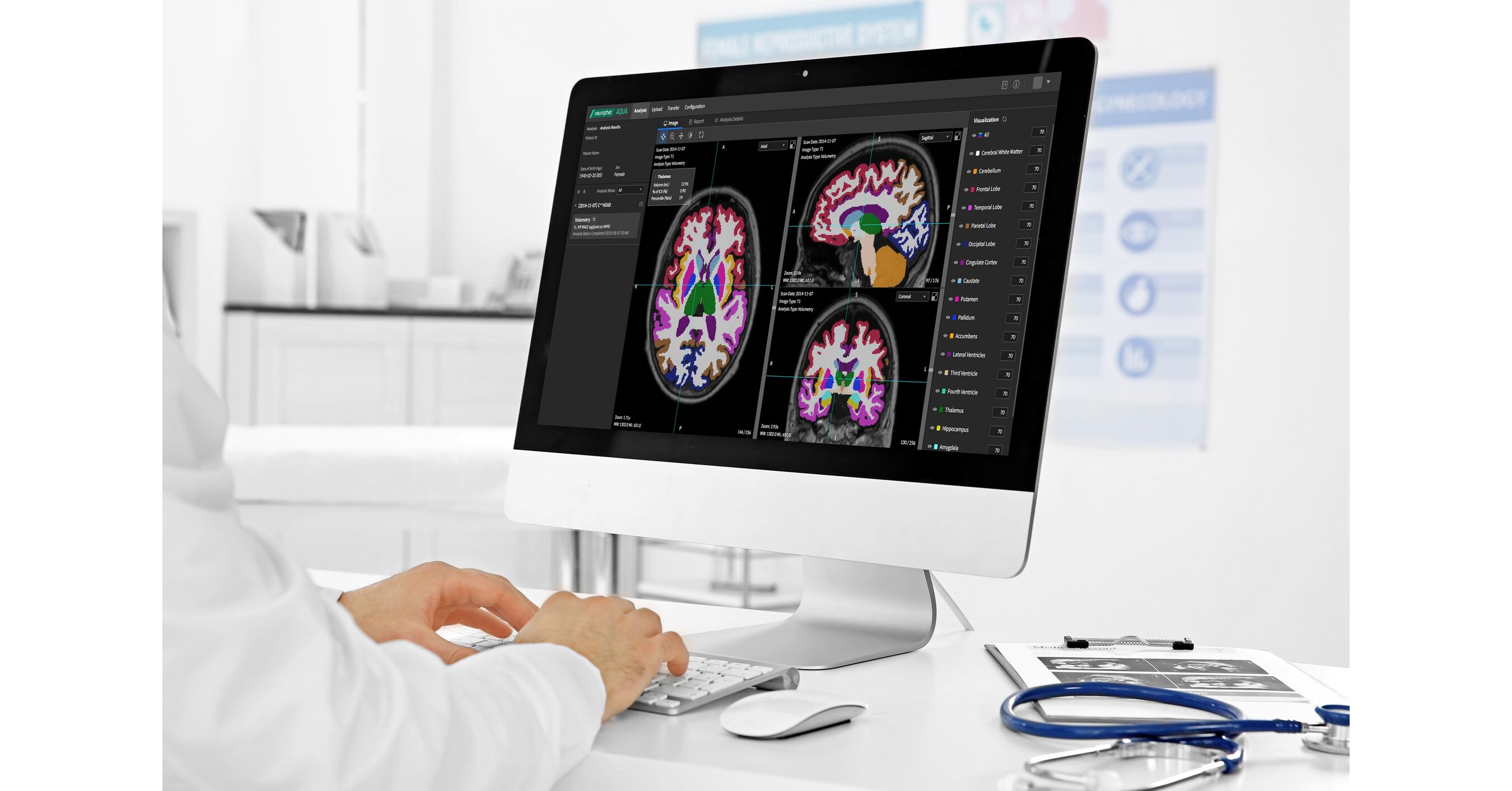 Neurophet Supplies 'Neurophet AQUA' to Raffles Medical in Singapore