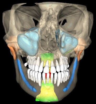 3D Image 1