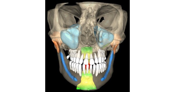 VELMENI Receives FDA 510(k) Clearance for AI-Powered 3D CBCT Dental Imaging Software