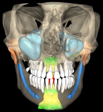 3D Image 1