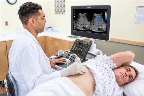 Using Philips' ultimate ultrasound liver solution, liver disease assessment is faster and more comfortable for patients than a traditional tissue biopsy.