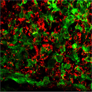 MicroRNA Treatment Restores Nerve Insulation, Limb Function in Mice with MS