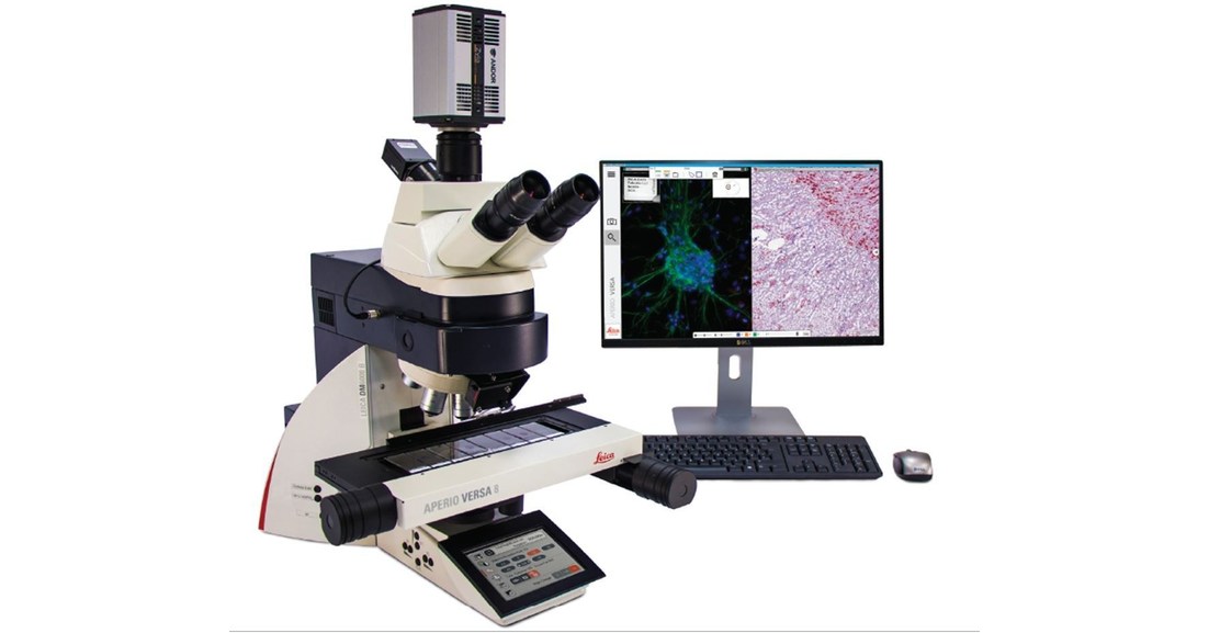 advances-in-leica-biosystems-aperio-versa-digital-pathology-for-cancer