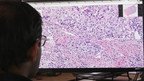 Philips and PathAI team up to improve breast cancer diagnosis using artificial intelligence technology in 'big data' pathology research