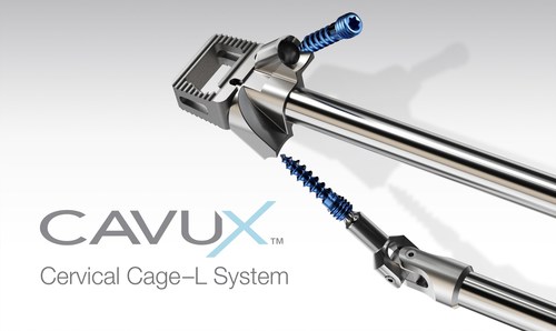CAVUX(TM) Cervical Cage-L System from Providence Medical Technology, Inc. is manufactured from medical grade titanium and available in a variety of sizes. The implant offers proprietary grit-blasted and acid-etched surfaces, a large space for allogenic and autogenous bone graft and includes self-drilling and self-tapping screws for additional, standalone fixation.