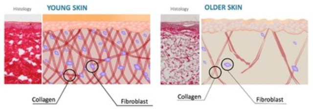 Positive Results From Replicel's Rcs-01 Phase I Skin Trial Are The 