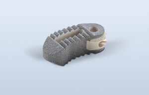 Aesculap Launches Novel Spine Device Warranty on its Plasmapore®XP Surface Enhancing Technology Portfolio for Spinal Fusion