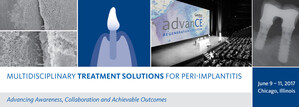 REGISTER TODAY: Multidisciplinary Treatment Solutions for Peri-Implantitis Symposium